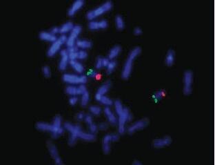 �ɹ⼰�뿹ԭ��(bi��o)ӛ�����������