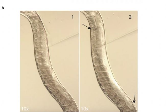 ���x�@΢ע����β�������Ԕ��(x��)��(sh��)�(y��n)���E����aס